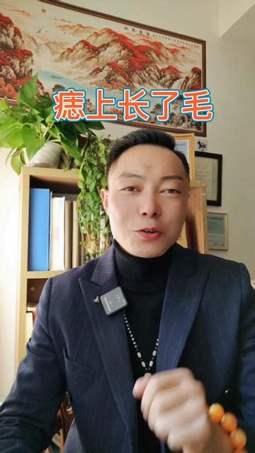 拔痣毛|黑痣上的毛，拔了会有什么影响。已经拔了好几年了。